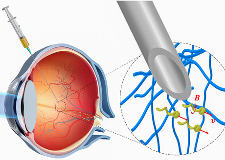 Nanorobots propel through the eye