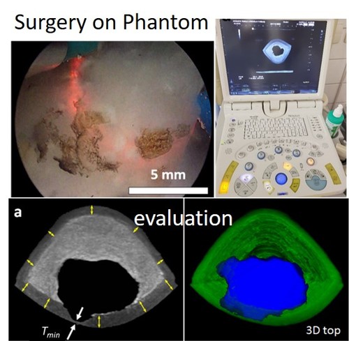 A High-Fidelity Phantom for the Simulation and Quantitative Evaluation of Transurethral Resection of the Prostate